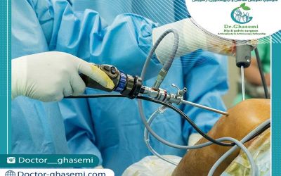 دکتر قاسمی فوق تخصص جراحی زانو و بازسازی رباط
