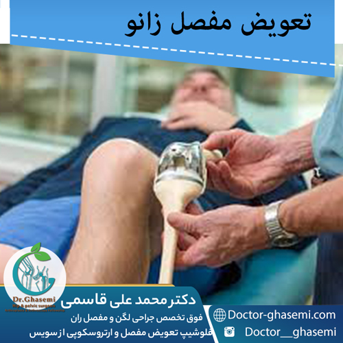 تعویض مفصل زانو