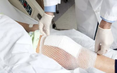 جراحی مجدد تعویض مفصل زانو در شیراز