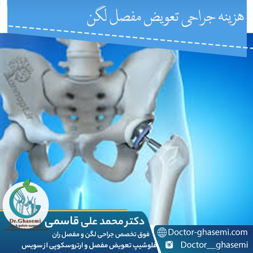 هزینه جراحی تعویض مفصل لگن در شیراز