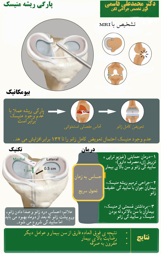 ترمیم منیسک