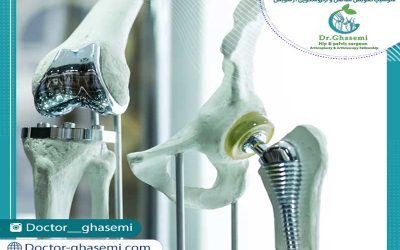 قبل از جراحی تعویض مفصل زانو، این 6 روش را امتحان کنید!