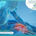 سوالات رایج تعویض مفصل زانو