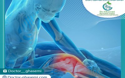 سوالات رایج بعد از تعویض مفصل زانو