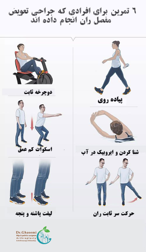 تمرینات تعویض مفصل ران