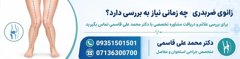 زانوی ضربدری