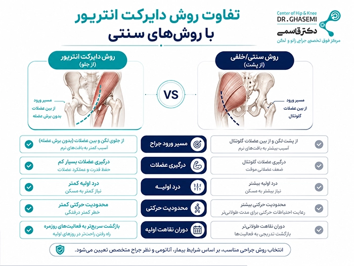 تفاوت روش دایرکت انتریور با روشهای سنتی