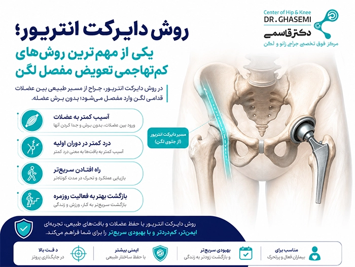 روش دایرکت انتریور چیست؟
