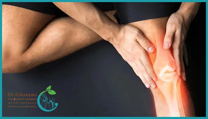 آیا جراحی مجدد تعویض مفصل زانو امکان پذیر است؟