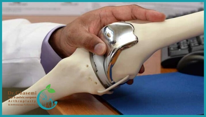 فوق تخصص زانو و لگن در شیراز