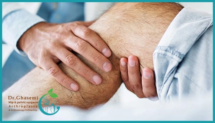 هزینه عمل بازسازی رباط