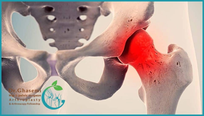 تشخیص سیاه شدن استخوان لگن چگونه انجام میشود؟