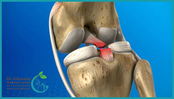 تکنیک‌های اصلی جراحی در نوجوانان