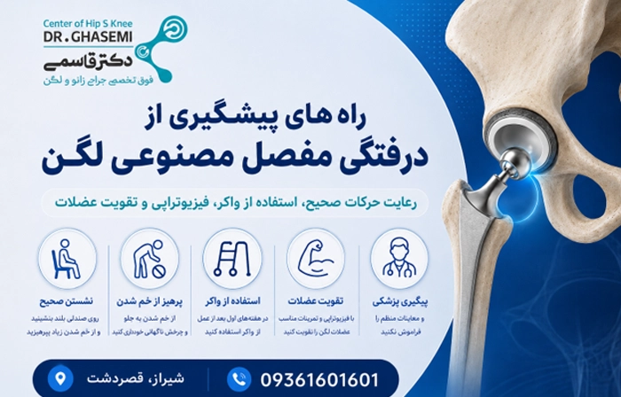 راههای پیشگیری از دررفتگی مفصل مصنوعی لگن