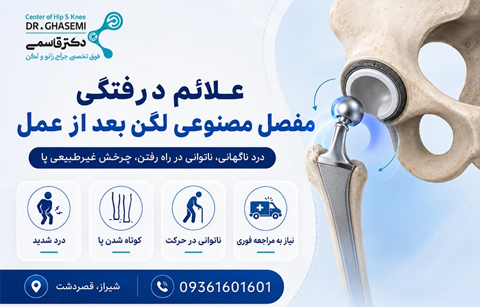 علائم دررفتگی مفصل مصنوعی لگن بعد از عمل