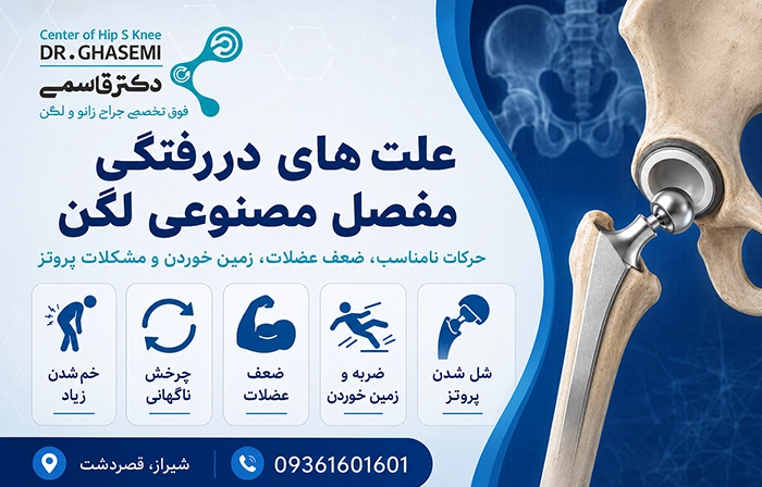 علت دررفتگی مفصل مصنوعی لگن چیست؟