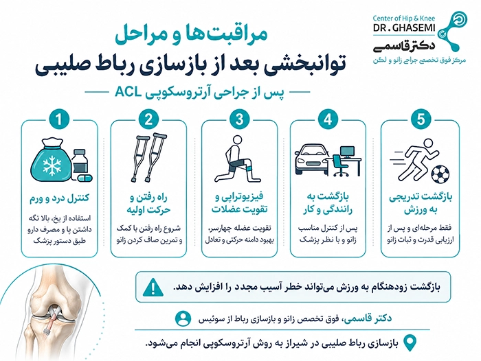 فیزیوتراپی بعد از عمل رباط صلیبی از چه زمانی شروع میشود؟
